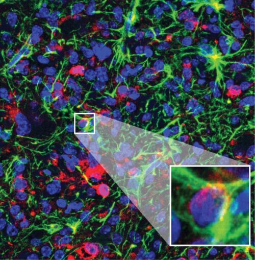 Image of DIPG tumor cell detail