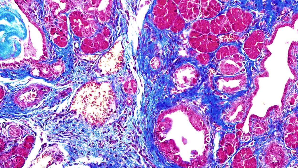 Image of mouse pancreas cells with SRSF1 protein