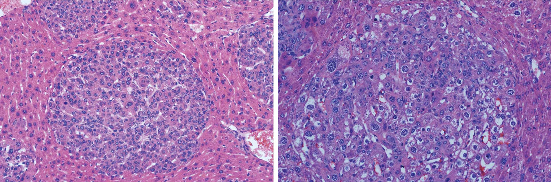 Image of mice liver tumor subtypes