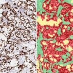 Images of mouse tumors with colorized cancer cells