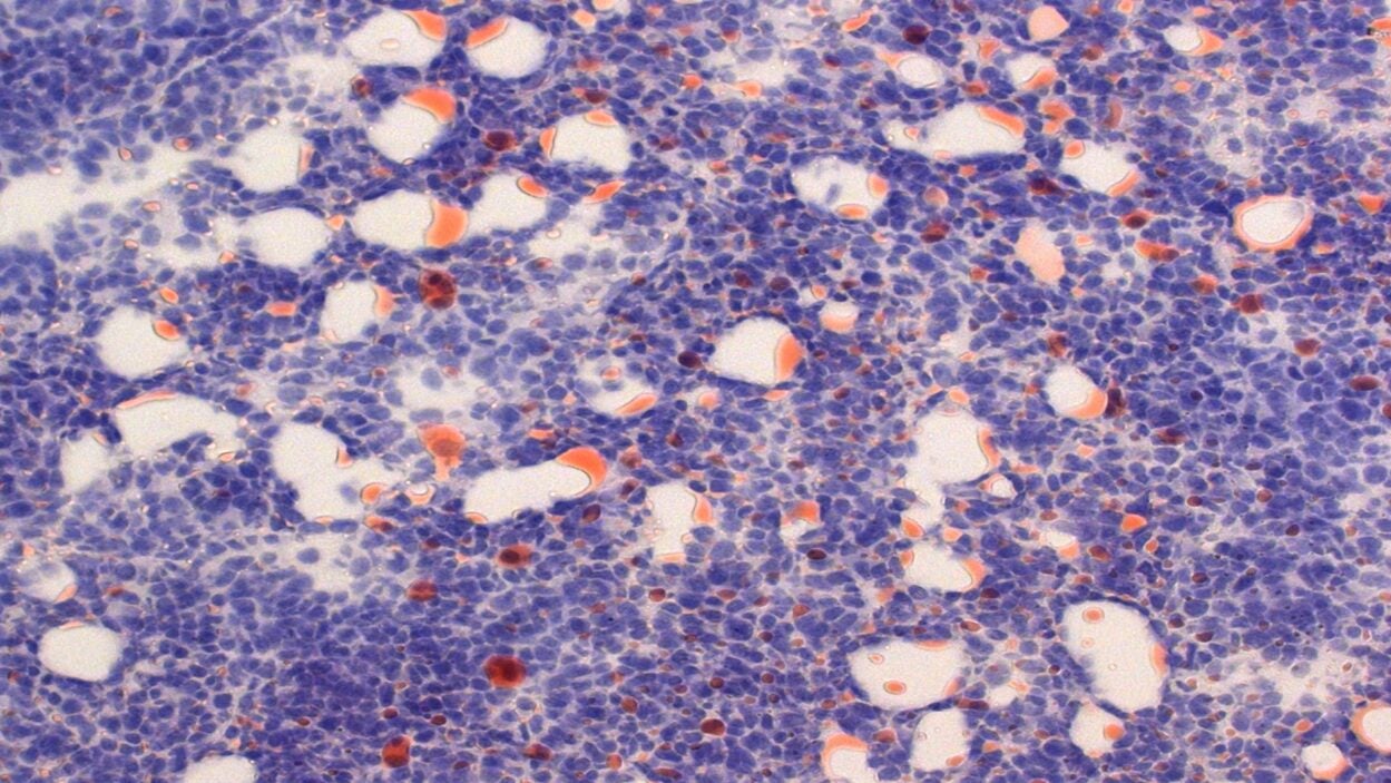 image of mouse cancer cells