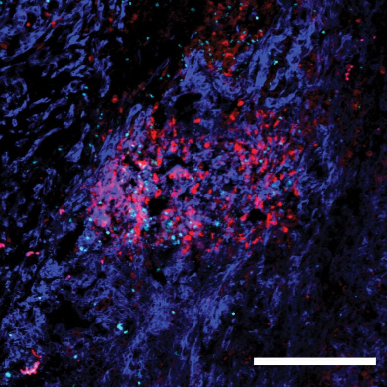 foxp3 anti-inflammatory cells