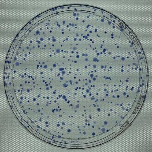 Photo of transposition assay