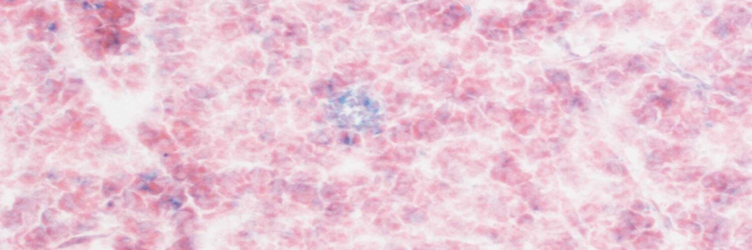 Image of mouse pancreatic tissue treated with CAR T cells