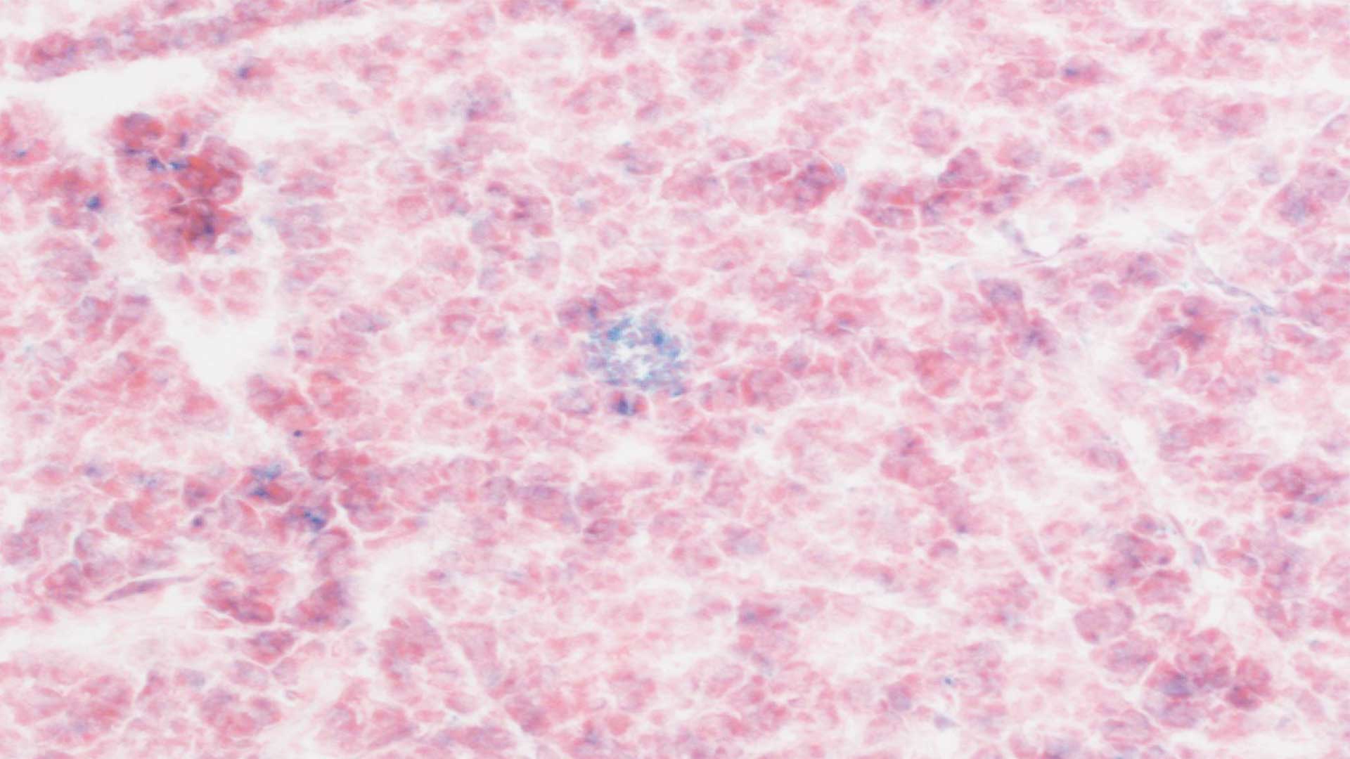 Image of mouse pancreatic tissue treated with CAR T cells