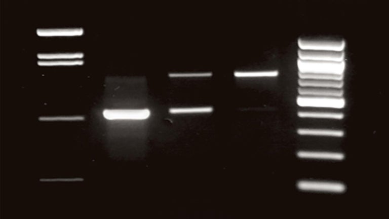 image of a DNA gel