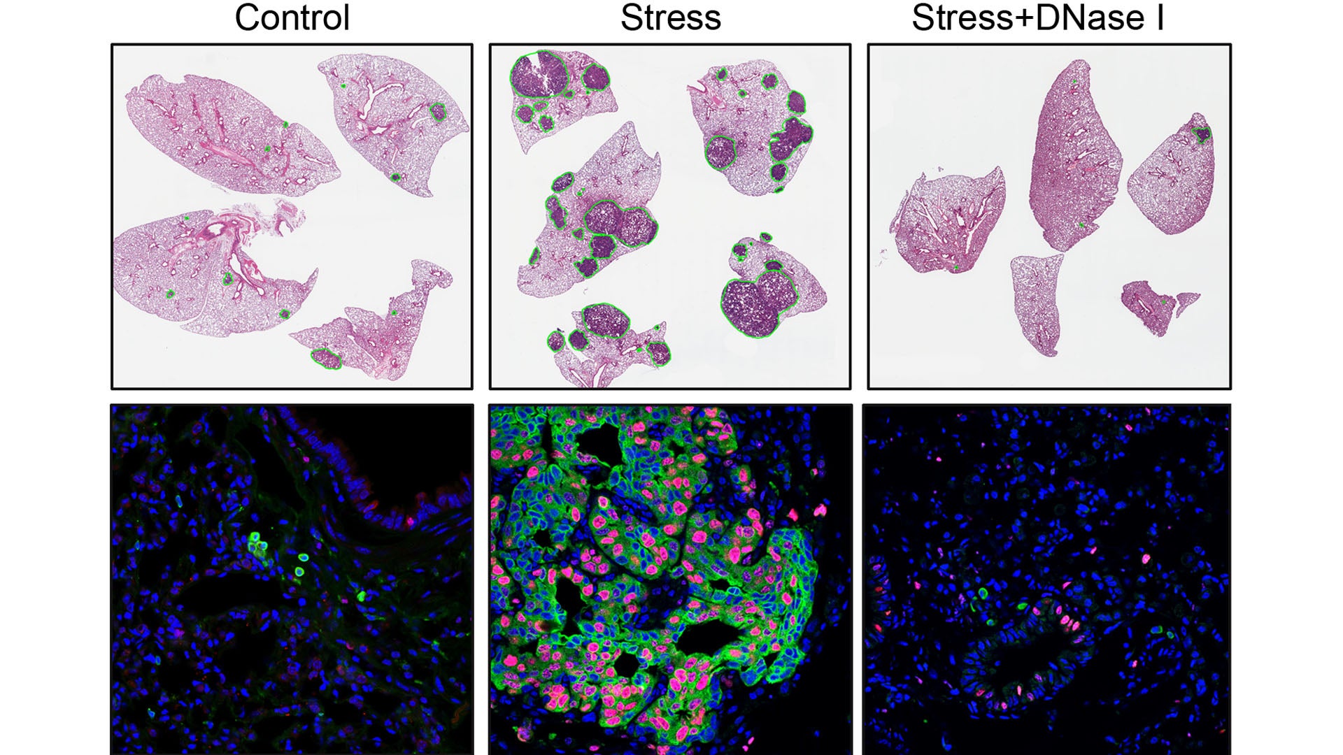 Image of comparisons in cancer growth with low stress, high stress, and DNase I