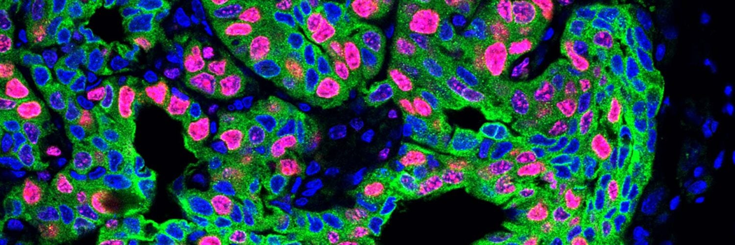 Image of lung cancer metastasis in a mouse