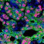 Image of lung cancer metastasis in a mouse