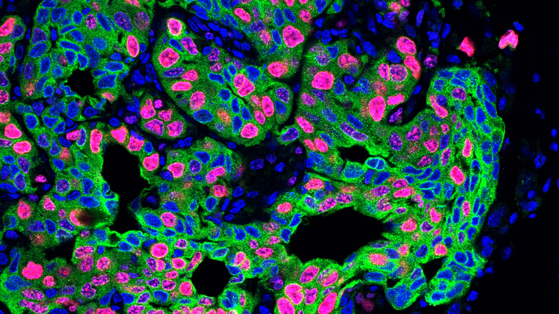 Image of lung cancer metastasis in a mouse