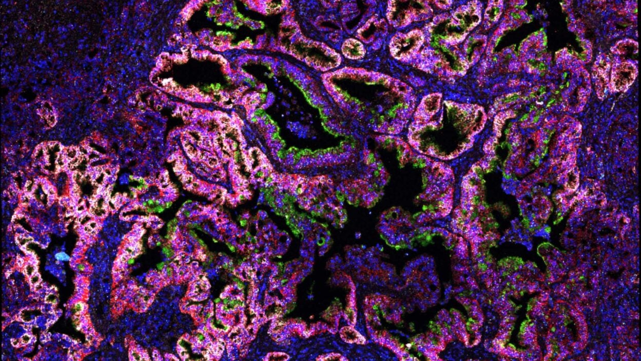 image of an early-stage pancreatic mouse tumor