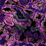 image of an early-stage pancreatic mouse tumor