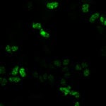 image of DDX23 enzyme