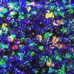 image of area postrema neurons
