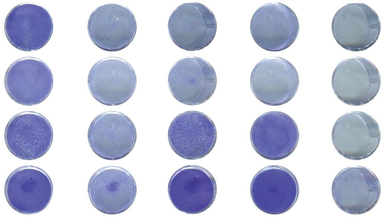 image of 2 types of pancreatic cancer cells