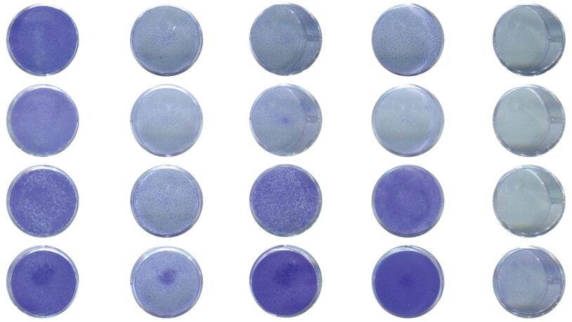 image of 2 types of pancreatic cancer cells