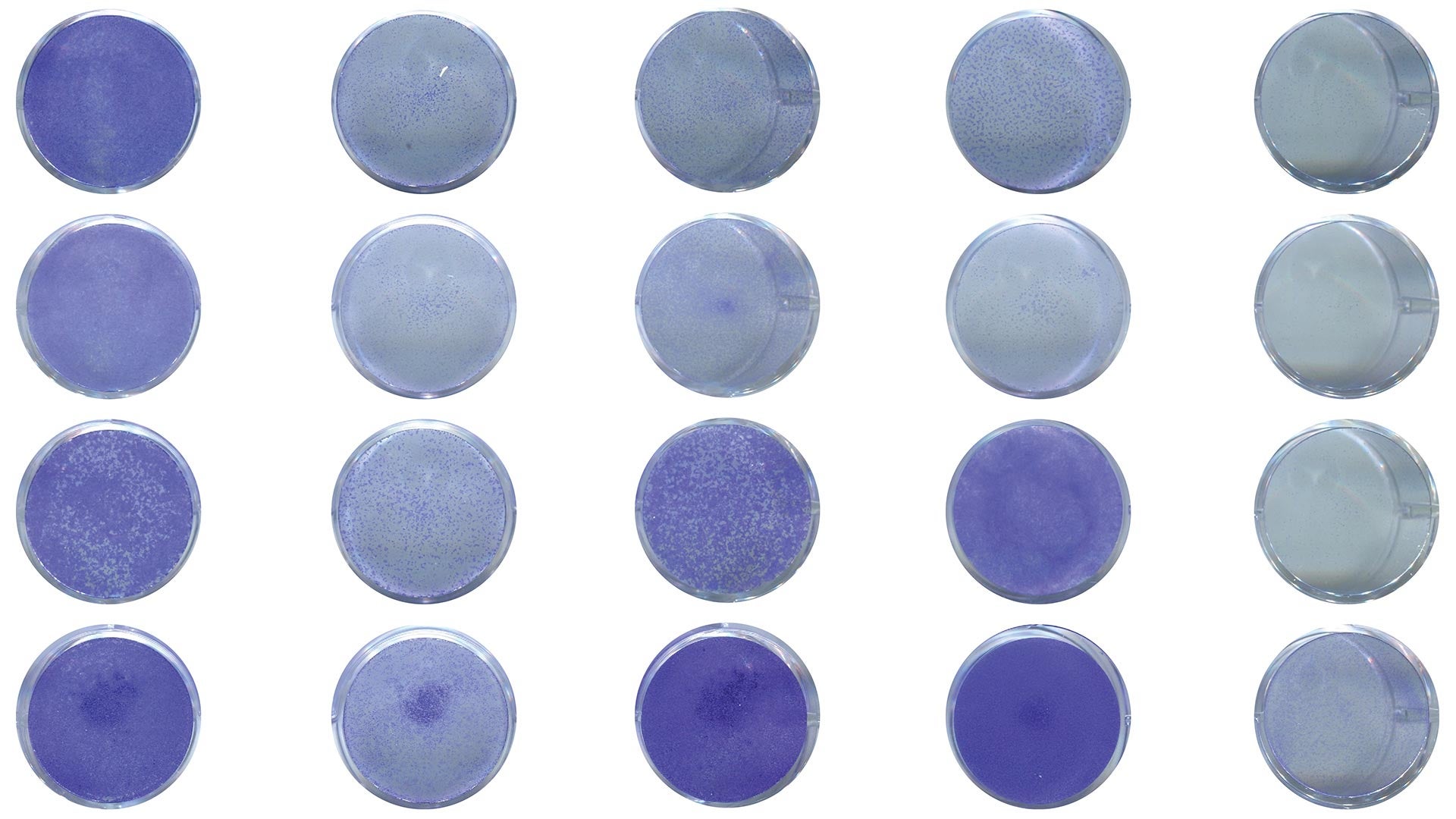 image of 2 types of pancreatic cancer cells