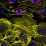 image of breast cells with mouse neurons