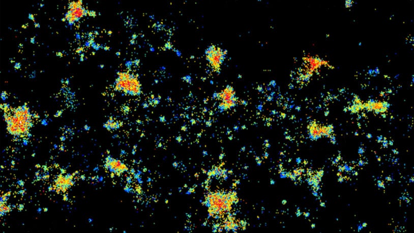 image of Anti-NMDAR encephalitis antibodies