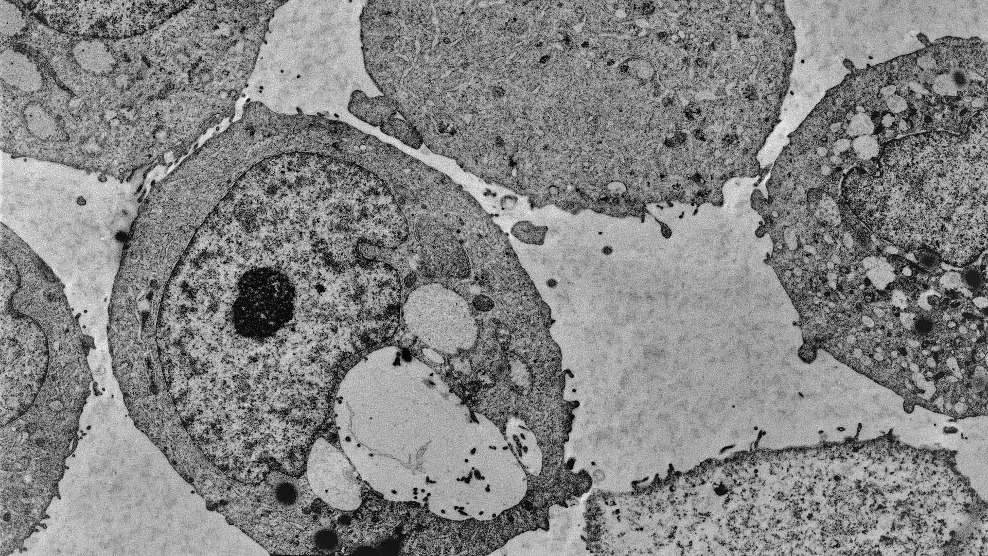 photo of menadione slowing prostate cancer growth
