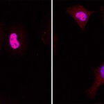 image of Lung Cancer cells