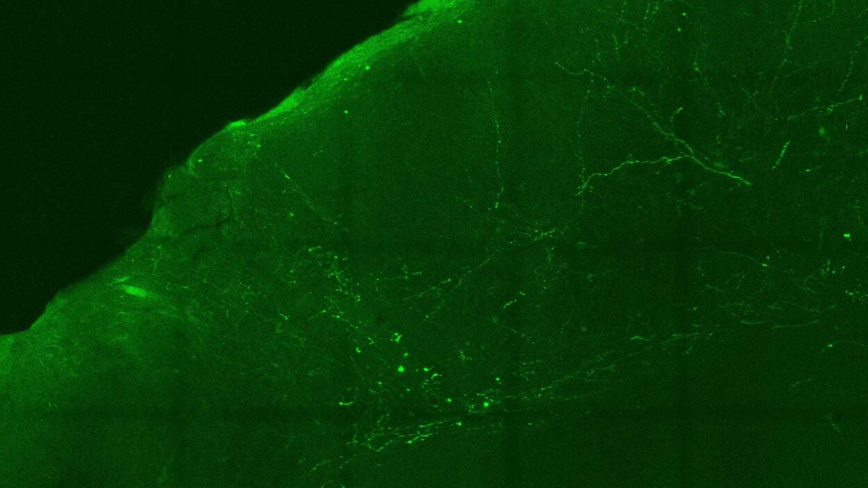 image of neural pathways stained green
