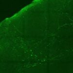 image of neural pathways stained green
