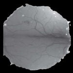 photo of the brain's olfactory bulb