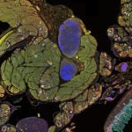 image of FGR2 and EGFR proteins
