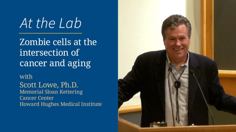image of Zombie cells at the intersection of cancer and aging