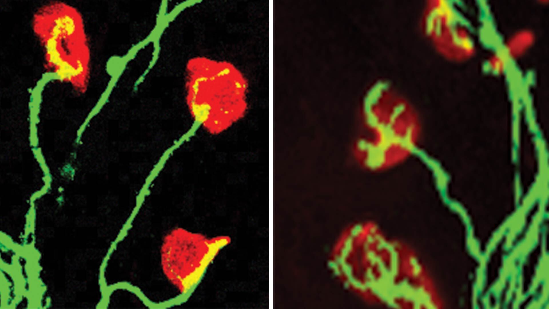 Fluorescent microscopy shows healthy (left) and damaged (right) nerve cells with red and green staining.