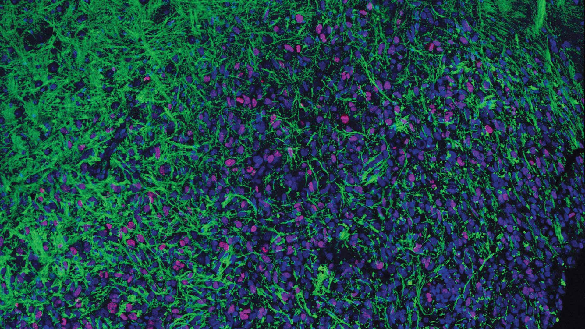 Fluorescent microscope image showing green neural fibers and purple-blue cells in brain tissue.