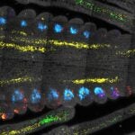 Microscopic view of a cell structure with blue, yellow, red, and green fluorescent markers.