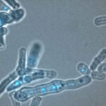 Image of yeast cells with visible DNA