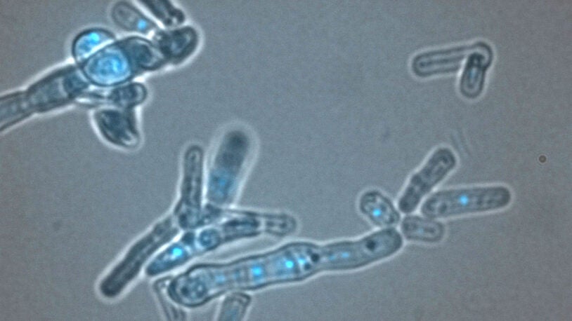 Dicer: Life’s ancient repair tool