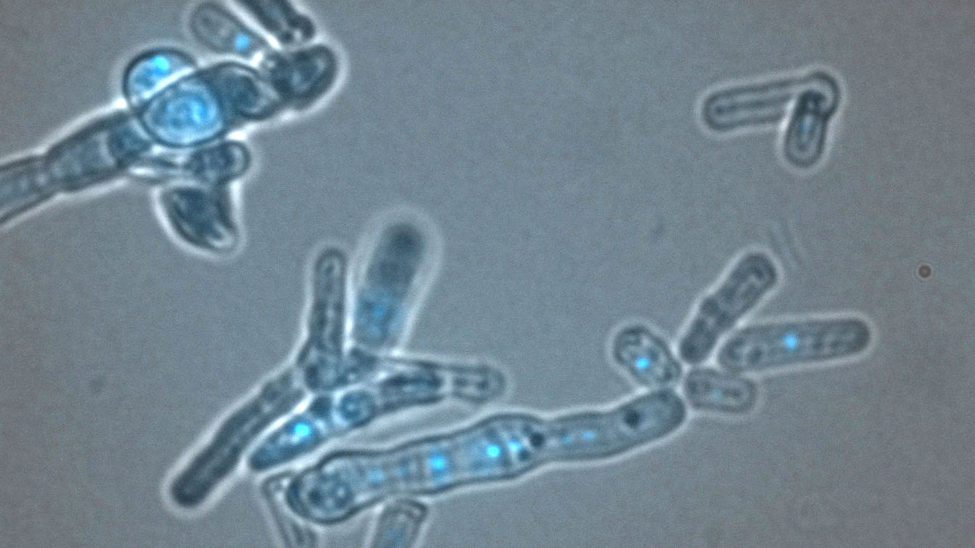 Image of yeast cells with visible DNA
