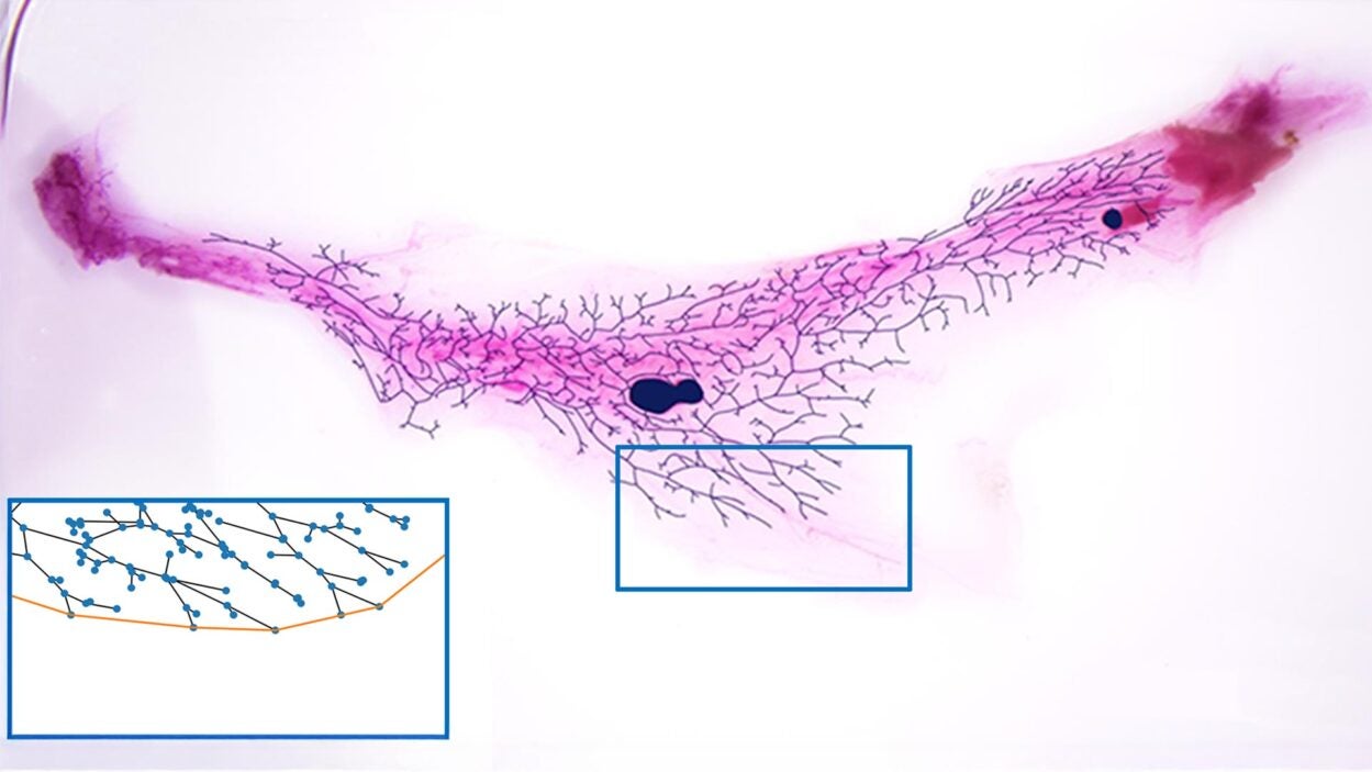Microscope image of a a mouse mammary gland’s ductal tree with dark branches and two blue inset boxes showing close-ups.