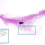 Microscope image of a a mouse mammary gland’s ductal tree with dark branches and two blue inset boxes showing close-ups.