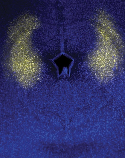 Singing mice speak volumes