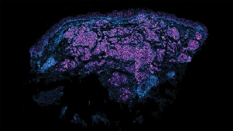 Fluorescent microscopy image showing clusters of blue and purple cells on a black background.