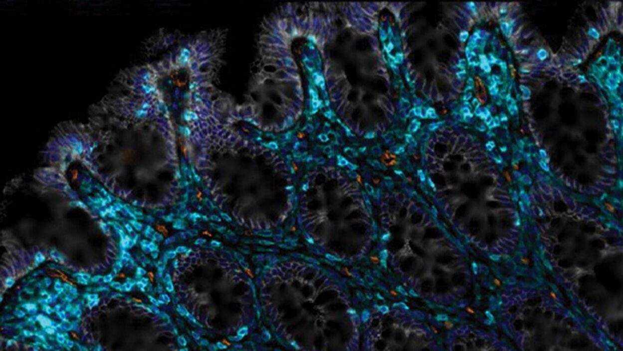 Microscopic view of tissue with blue, orange, and black highlighted cells and intricate structures.