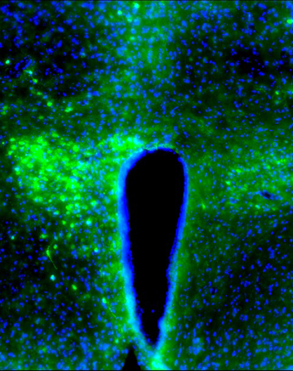 Day & night: Cancer disrupts the brain’s natural rhythm