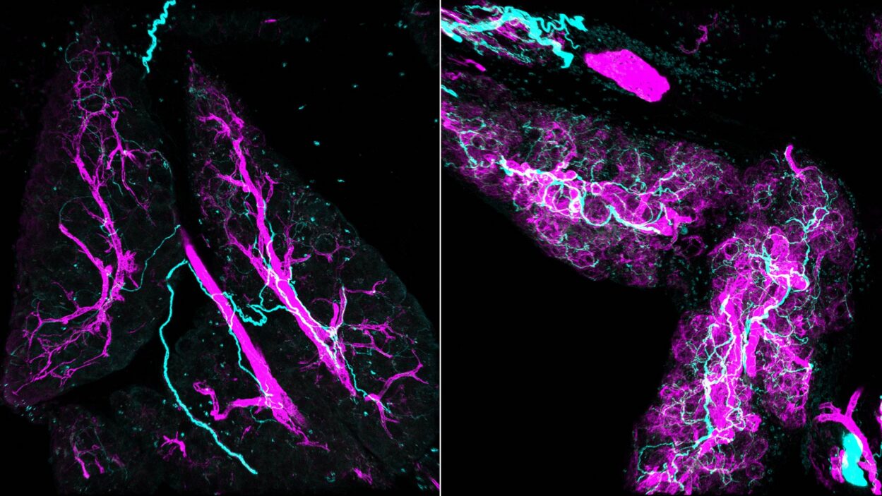 Microscopic view of neural networks in tissue, highlighted in bright magenta and cyan on a black background.
