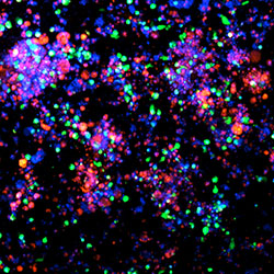 CSHL develops endometrial cancer organoid platform