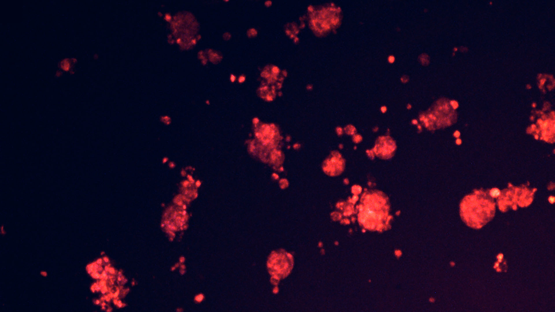 Clusters of glowing red cells or particles scattered on a dark blue background, seen under a microscope.